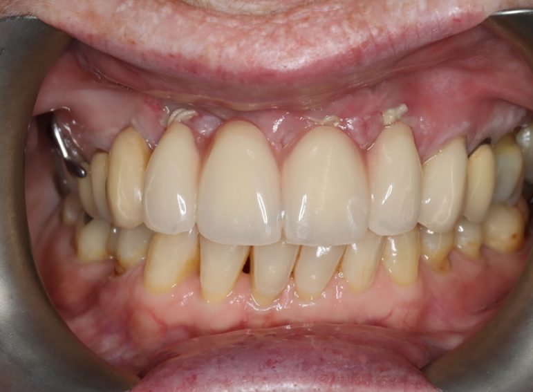 After -  Graystone Referral Centre