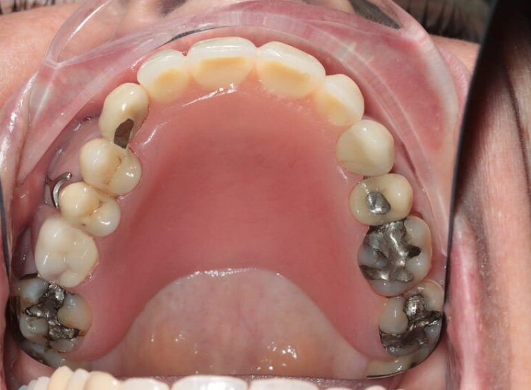 Before -  Graystone Referral Centre