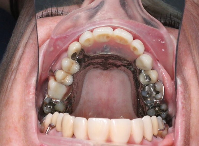 After -  Graystone Referral Centre