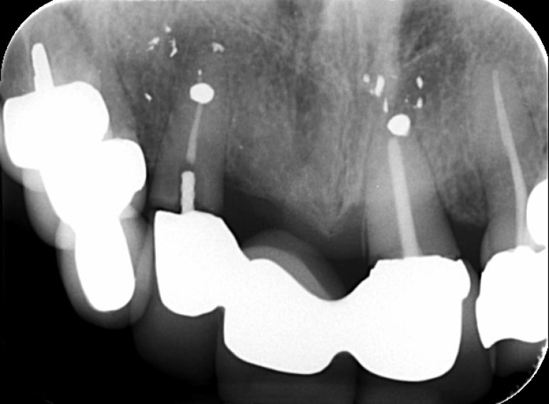 Before -  Graystone Referral Centre