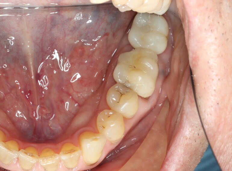 After -  Graystone Referral Centre