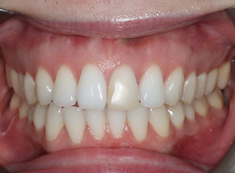 After -  Graystone Referral Centre