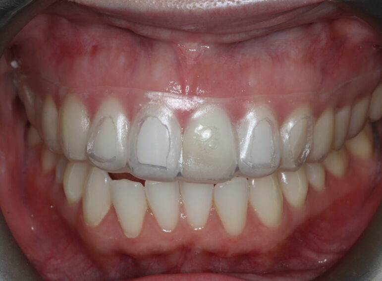 After -  Graystone Referral Centre
