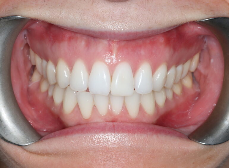 Before -  Graystone Referral Centre