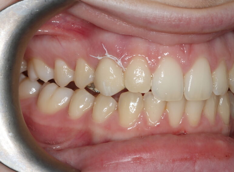 Before -  Graystone Referral Centre