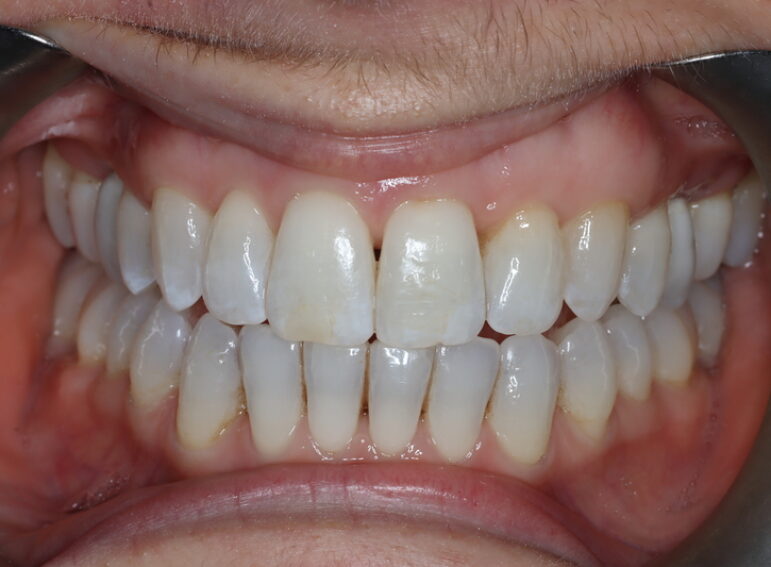 After -  Graystone Referral Centre