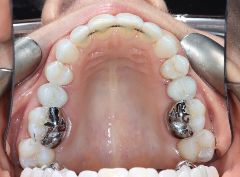 Before -  Graystone Referral Centre