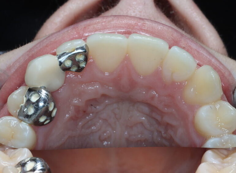 After -  Graystone Referral Centre