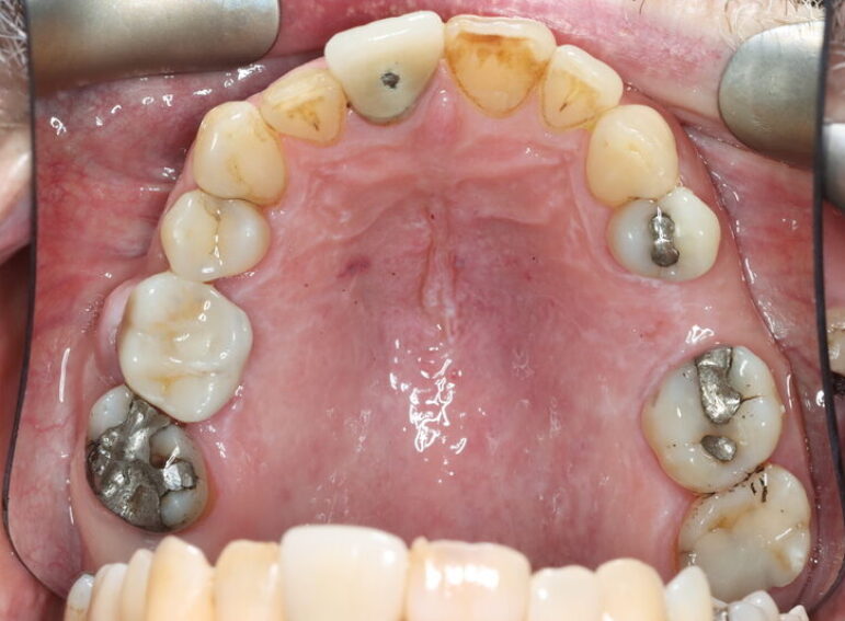 After -  Graystone Referral Centre