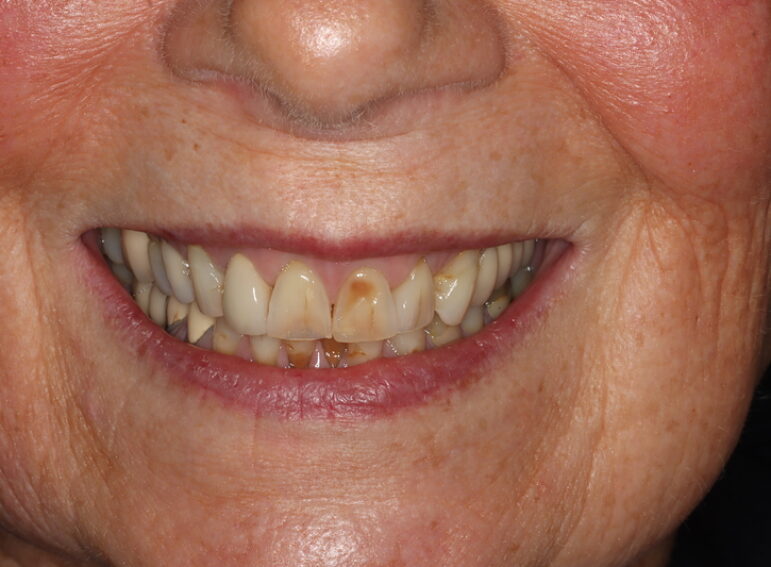 Before -  Graystone Referral Centre