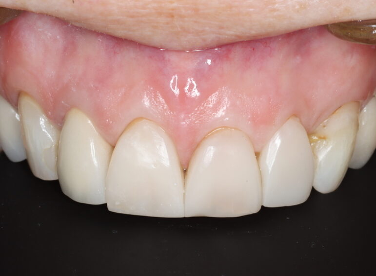 Before -  Graystone Referral Centre