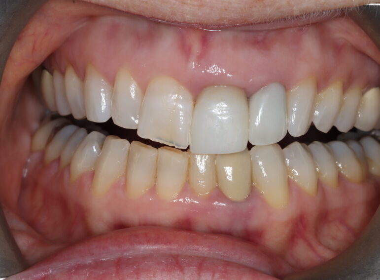 After -  Graystone Referral Centre