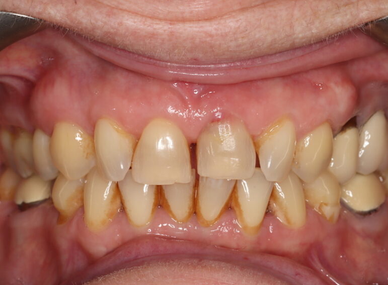 Before -  Graystone Referral Centre