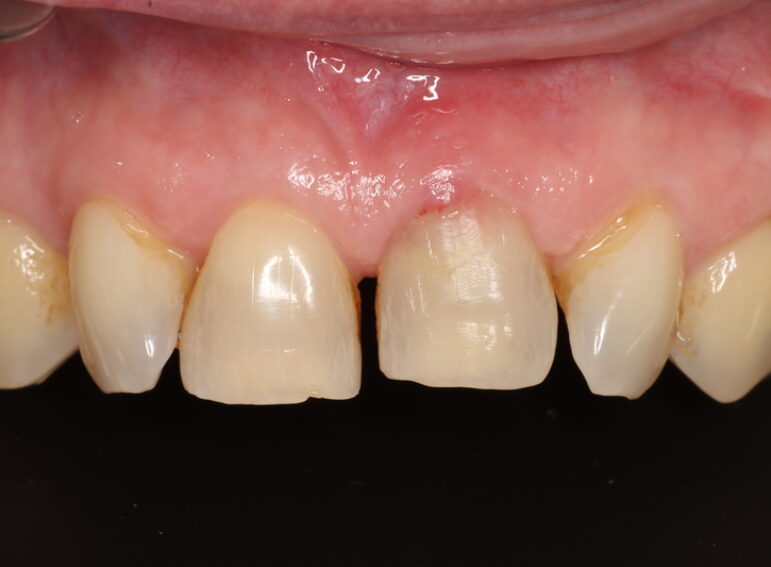 After -  Graystone Referral Centre