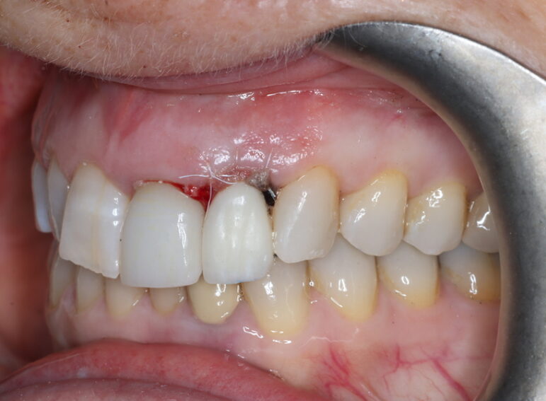 Before -  Graystone Referral Centre