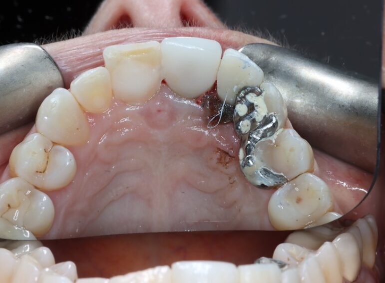 After -  Graystone Referral Centre