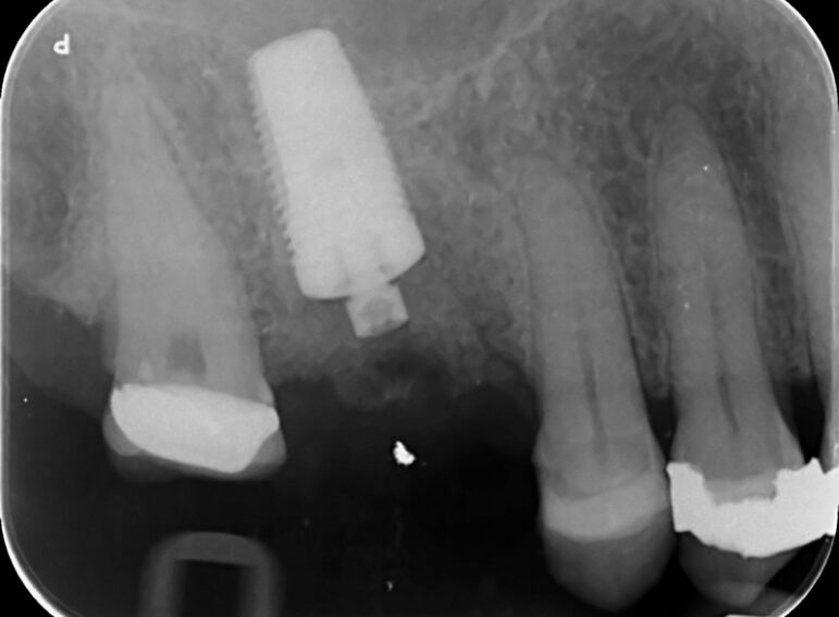 After -  Graystone Referral Centre