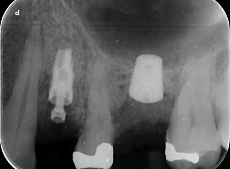 After -  Graystone Referral Centre