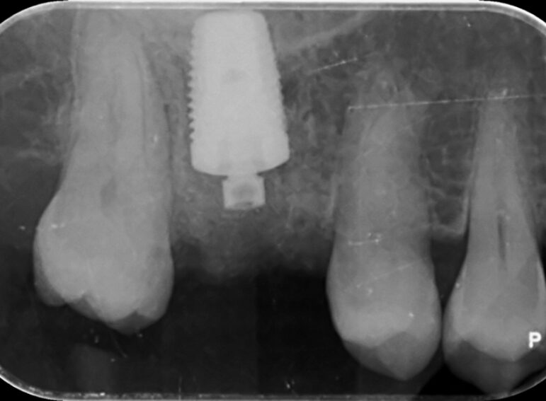 After -  Graystone Referral Centre