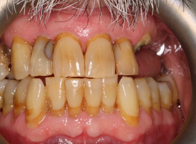 Before -  Graystone Referral Centre