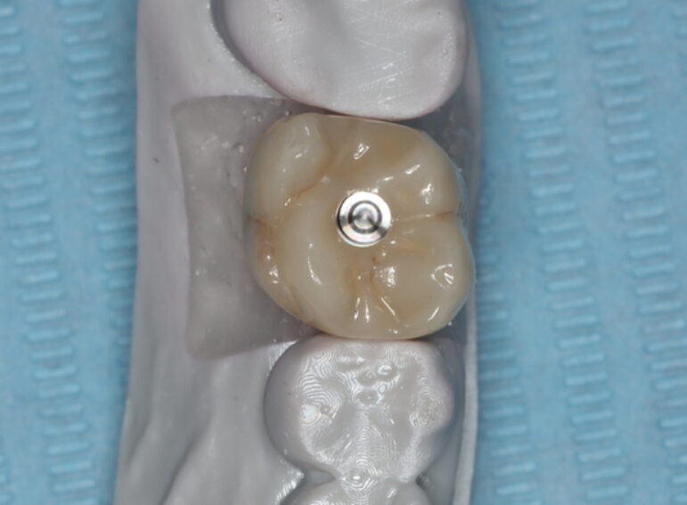 Before -  Graystone Referral Centre