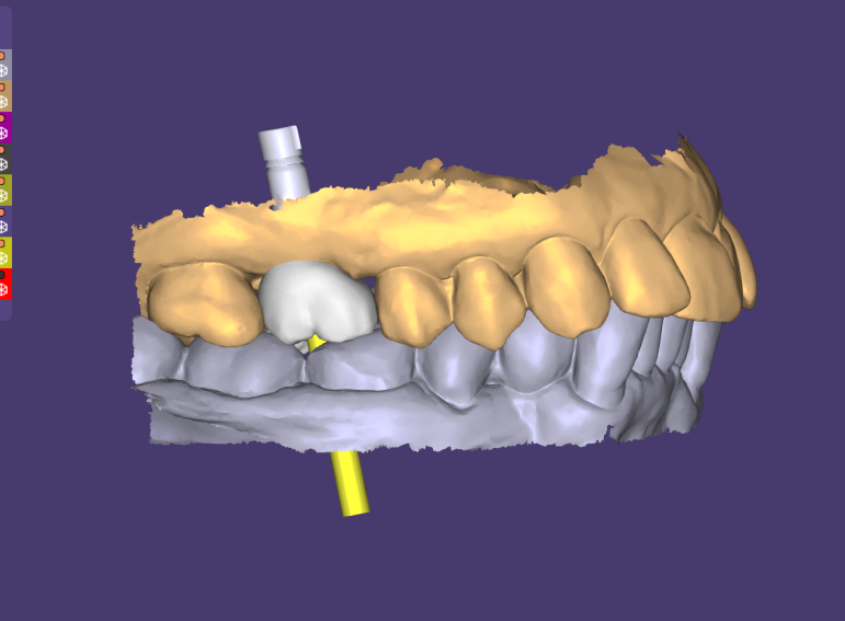 After -  Graystone Referral Centre