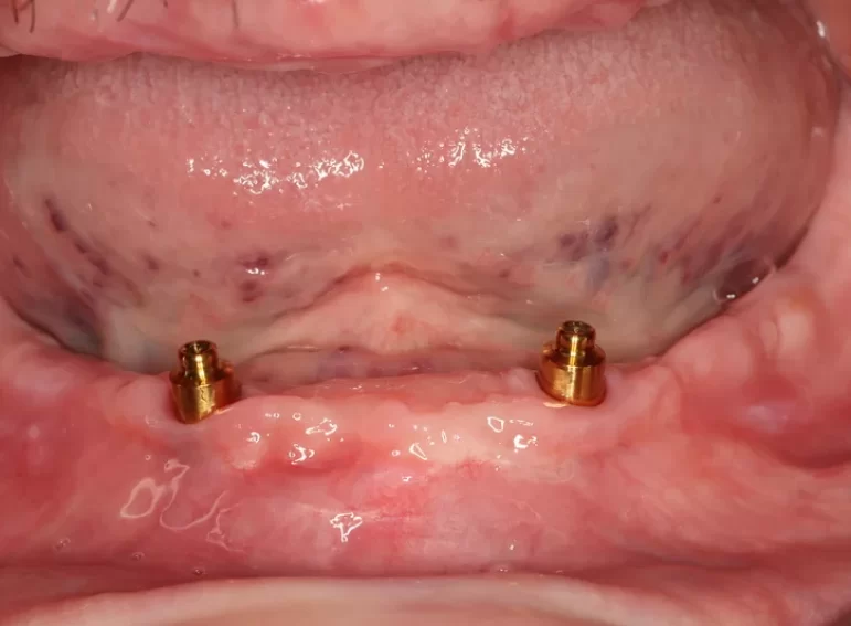 Before -  Graystone Referral Centre