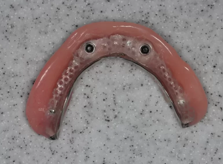 After -  Graystone Referral Centre