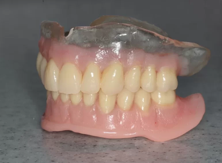 Before -  Graystone Referral Centre