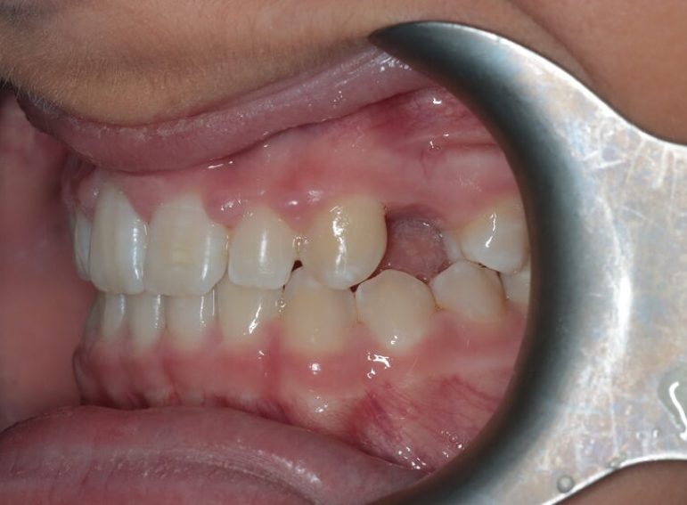 Before -  Graystone Referral Centre