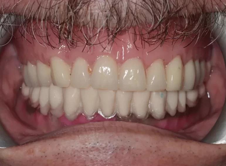 After -  Graystone Referral Centre