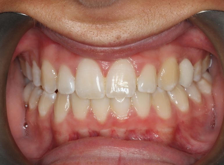 After -  Graystone Referral Centre