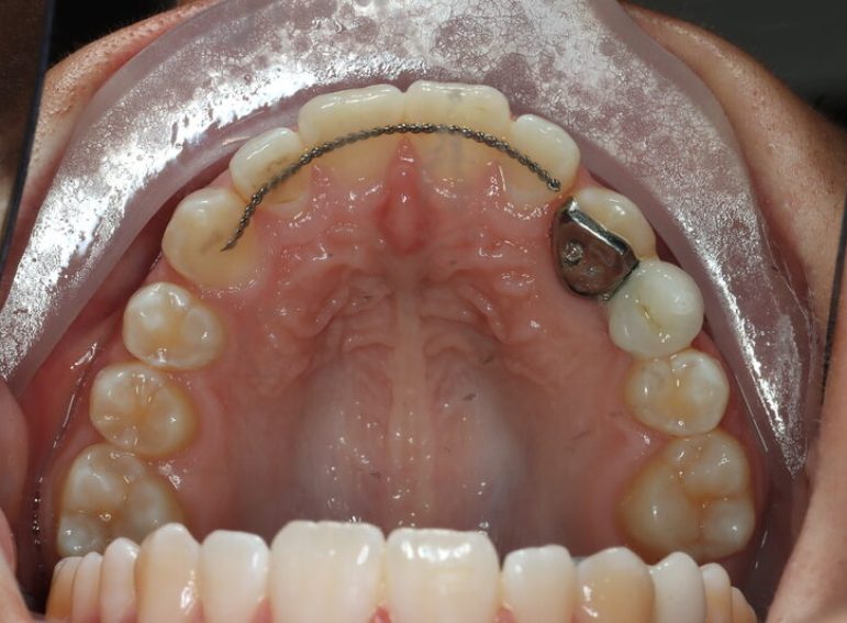 Before -  Graystone Referral Centre