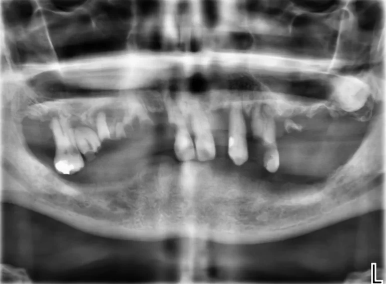 Before -  Graystone Referral Centre