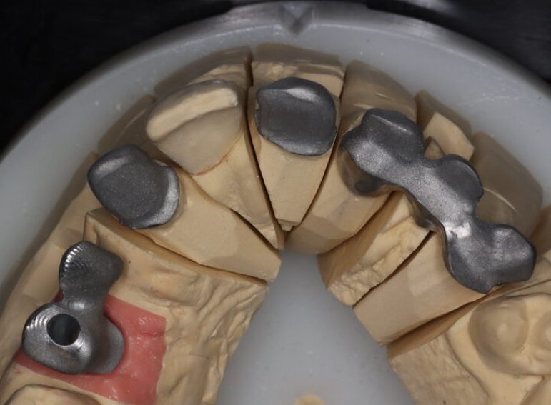 After -  Graystone Referral Centre