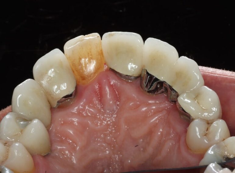 Before -  Graystone Referral Centre