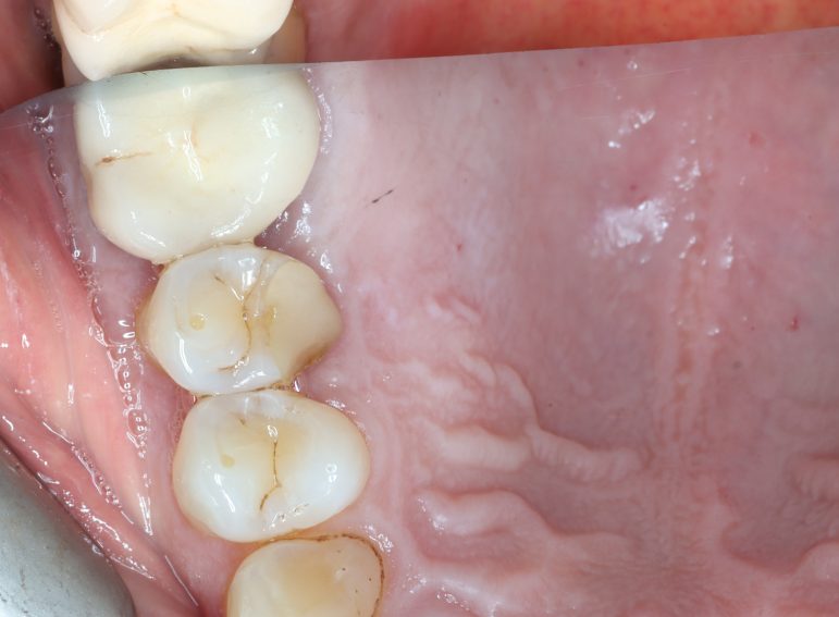 After -  Graystone Referral Centre