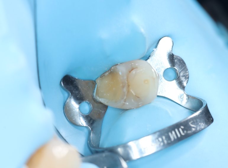 Before -  Graystone Referral Centre