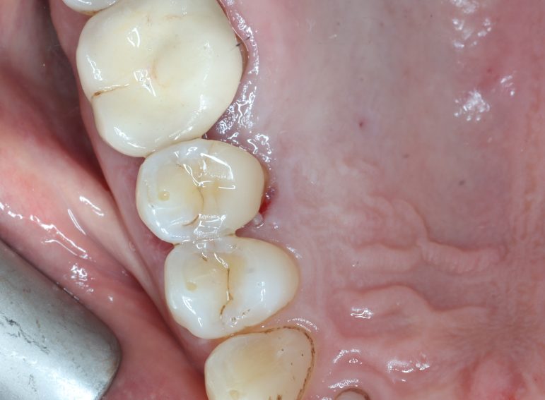 After -  Graystone Referral Centre