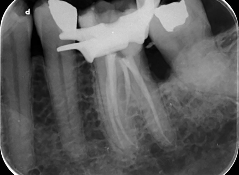 After -  Graystone Referral Centre