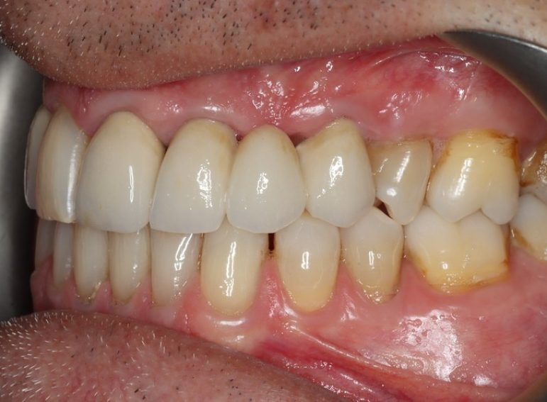 Before -  Graystone Referral Centre