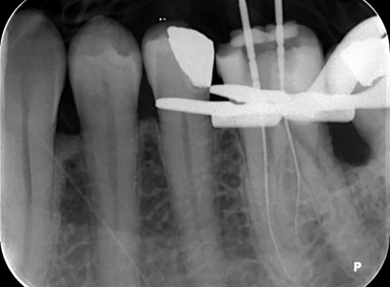 Before -  Graystone Referral Centre