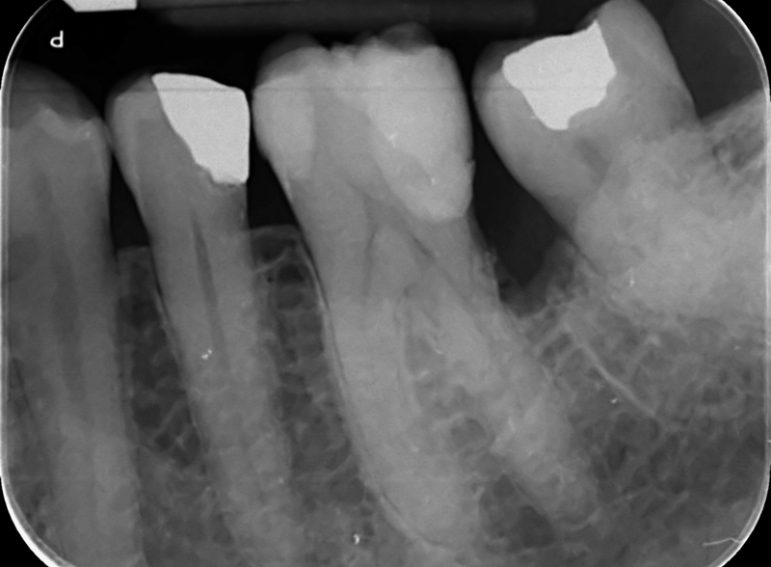 After -  Graystone Referral Centre