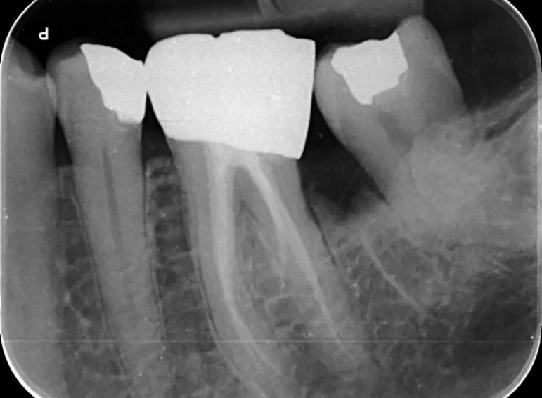 Before -  Graystone Referral Centre