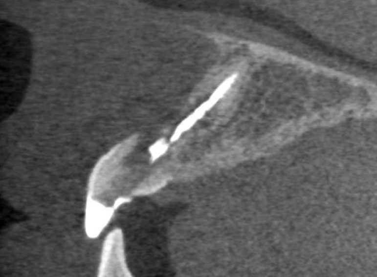 Before -  Graystone Referral Centre