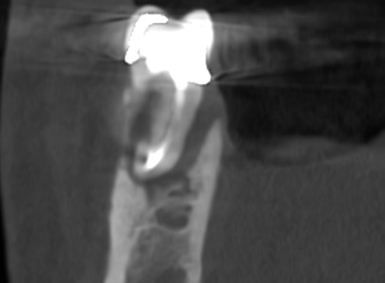 After -  Graystone Referral Centre