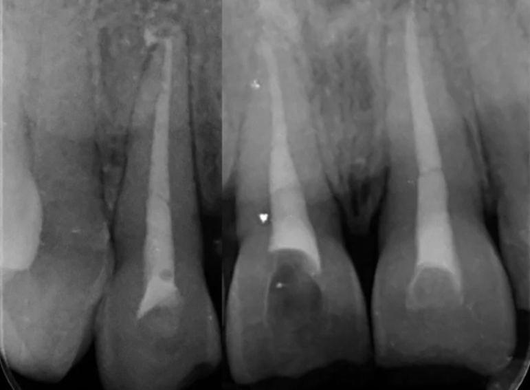 Before -  Graystone Referral Centre