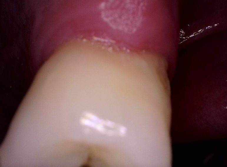 After -  Graystone Referral Centre