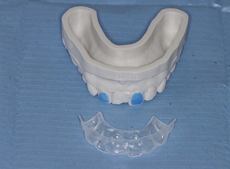 After -  Graystone Referral Centre