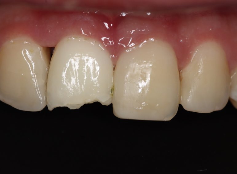 Before -  Graystone Referral Centre